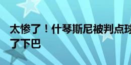 太惨了！什琴斯尼被判点球+还被萨比策踢到了下巴