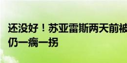 还没好！苏亚雷斯两天前被林良铭撞伤，今天仍一瘸一拐